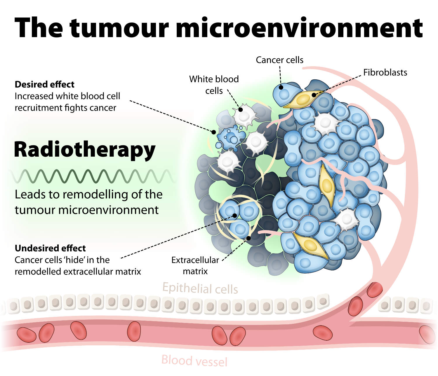 The effects of radiotherapy on the tumour microenvironment